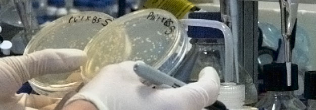 looking for colonies of cells