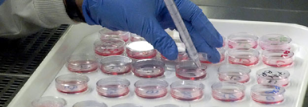 plating out cells into dishes for incubation