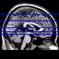 Animation of sagittal image sequence
