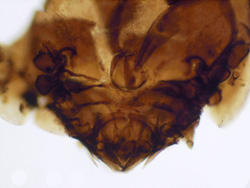 A microscope image of a fossilised oribatid mite