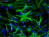 astrocytes