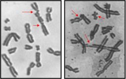 chromosomes