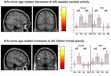 Shift from parietal to frontal activation