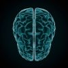 xray of brain 3