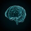 xray of brain 5