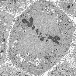 Mitotic HeLa Cell
