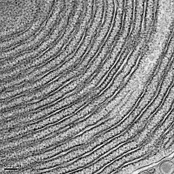 Rough Endoplasmic Reticulum