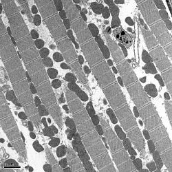 Fruitfly Muscle Fibres