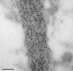 TDP-43-immunoreactive neurite in an FTLD with TDP-43 proteinopathy brain