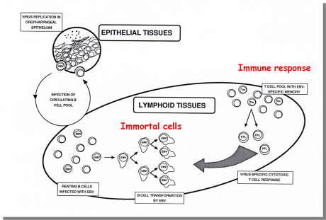 Infection by Epstein-Barr virus