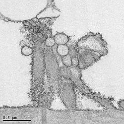 ferritin labelled blebs