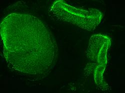 otoancorin vestibule