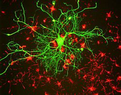 A digital representation of some neurons