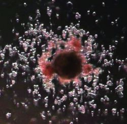 A microscopic image of a leukaemia cell