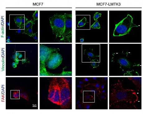 Confocal microscopy analysis of F-actin protrusions, viniculin localization, and FAK abundance in MCF7 and MCF7- LMTK3 cells.