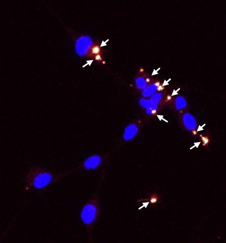 exosomes PKH26