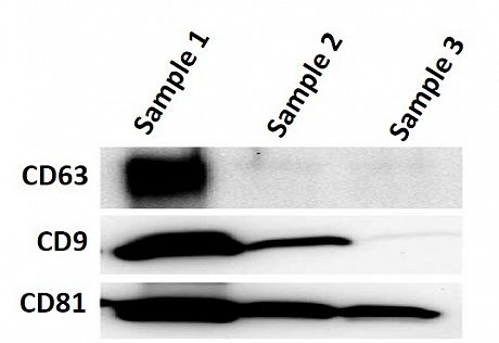 exosomes markers