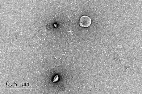 Exosomes TEM