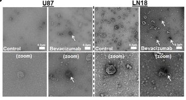 Extracellular vesicles in glioblastoma