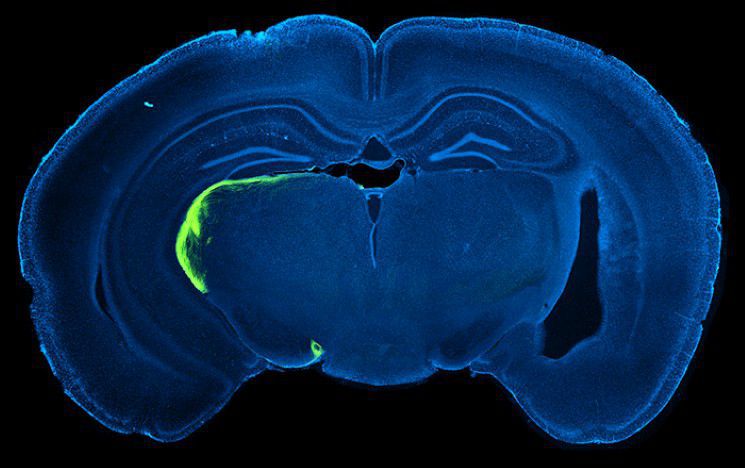 Brain slice