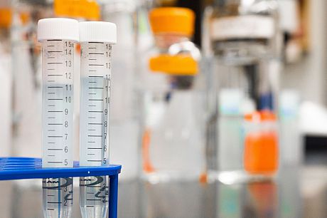 Test tubes sitting in holders in a lab