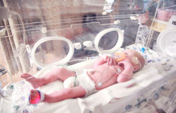 A premature baby lies in an incubator in a hospital connected to wires and breathing assistance