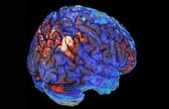 Medical scan of a human brain with black background, mostly blueish tones with some red and white highlighted areas