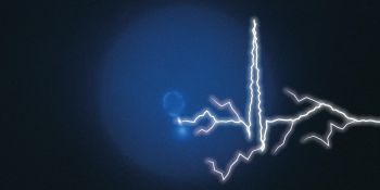 An illustration of a cardiogram that also looks like lightening against a thundery sky.