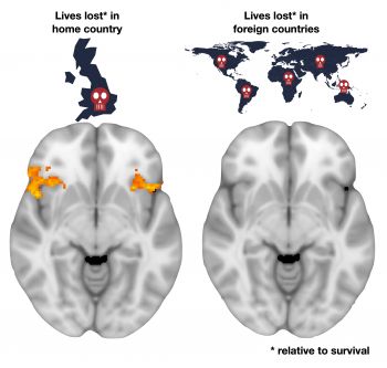 An image of brain scans highlights the difference in response to deaths in the UK and deaths abroad
