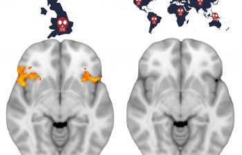 An image of brain scans highlights the difference in response to deaths in the UK and deaths abroad