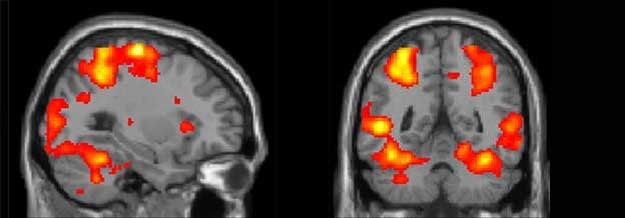 2 Brains being scanned