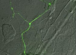 Motor neuron expressing Green fluorescent protein