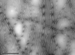 Amyloid fibrils