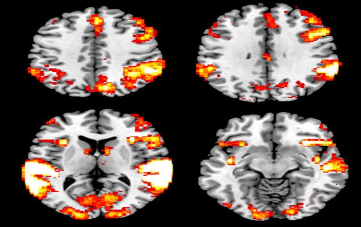 Brain scan images