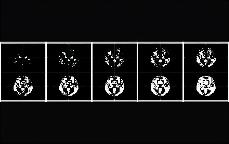 Peter Wijeratne Brain image