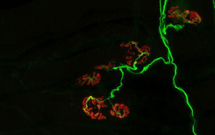 Neuro image