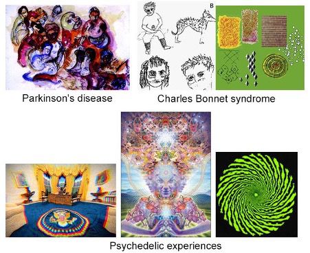 collated images of visual hallucinations including psychedelic White House oval office, Parkinsons disease, Charles Bonnet syndrome