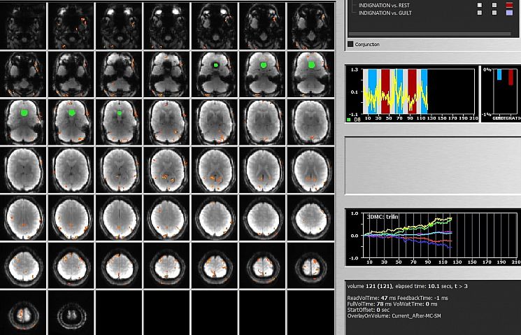 Screenshot showing scan images of a brain in grid format alongside a key explaining contrast categories of 'guilt versus rest', 'indignation versus rest' and 'indignation versus guilt'. Two graphs showing brain activity.