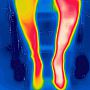 An infrared image of a persons legs with hot areas showing red and cold areas blue