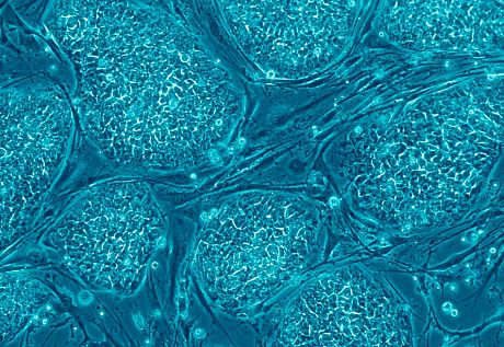Embryonic stem cells stained blue as seen under a microscope. Credit: Nissim Benvenisty, Wikimedia.