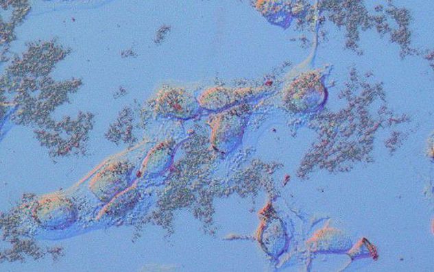 Bone carcinoma on a thin film MoS2 substrate