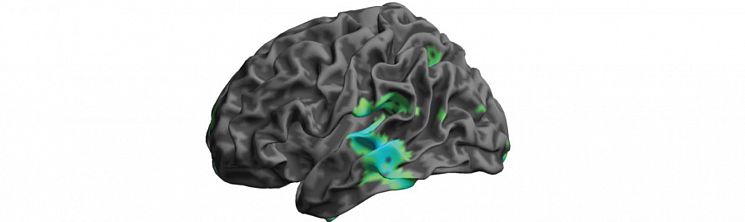 Where perceptual learning changes brain responses