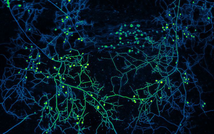 The roots of fungi in neon green against a dark blue background
