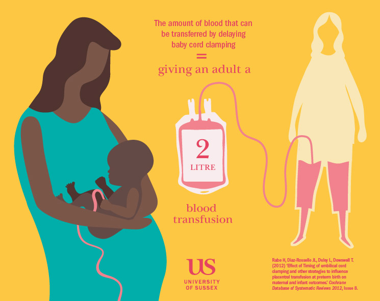 Graphic showing that the amount of blood transferred to the baby from the mother by delaying cord clamping is the equivalent of giving an adult a two litre blood transfusion