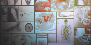 A montage of radiology images
